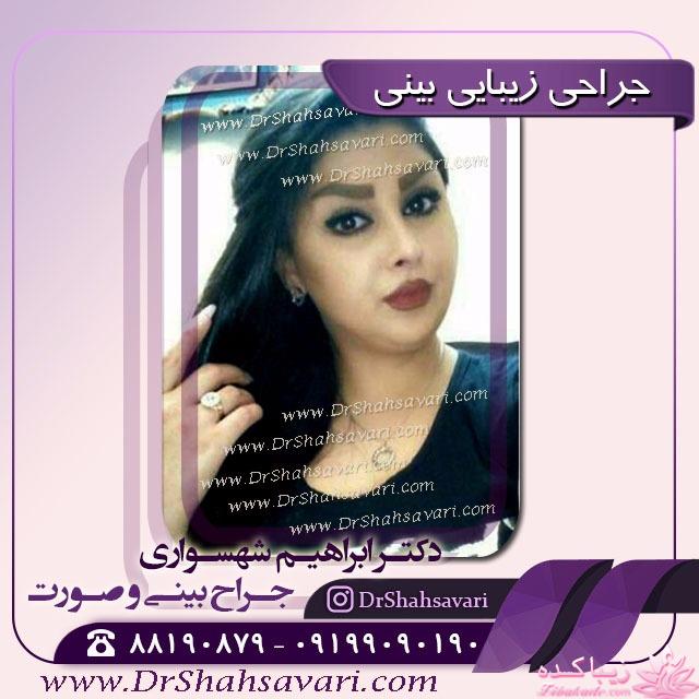 بهترین جراح بینی در تهران 